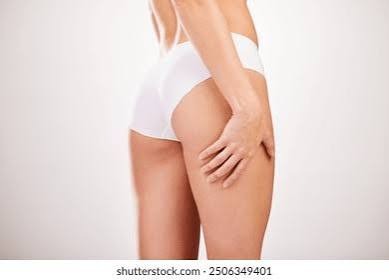 Fesses